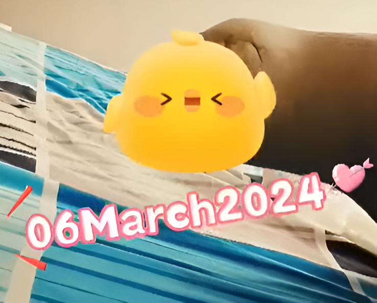 【用视频记录截肢生活】一位截肢小哥哥的生活vlog - 愿每一个人都健康幸福